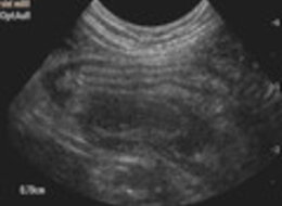Ultraschall